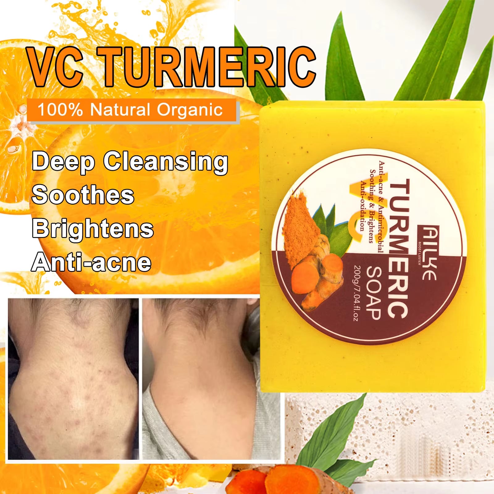 Organic Turmeric Soap Bar, Whiten, Reduce Acne, Pimples, Blackheads, Brightening, Clean Skin, Even Skin Tone