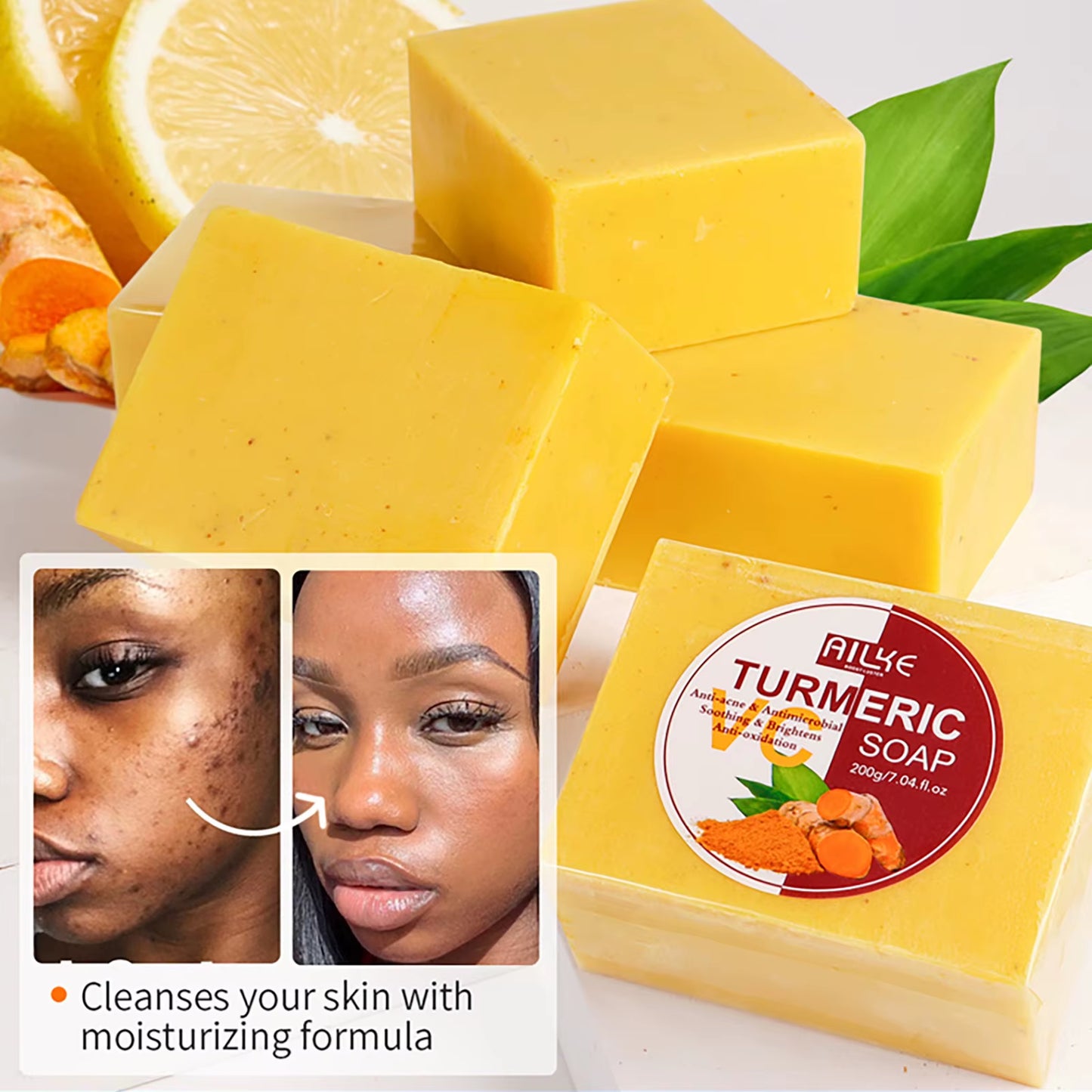 Organic Turmeric Soap Bar, Whiten, Reduce Acne, Pimples, Blackheads, Brightening, Clean Skin, Even Skin Tone