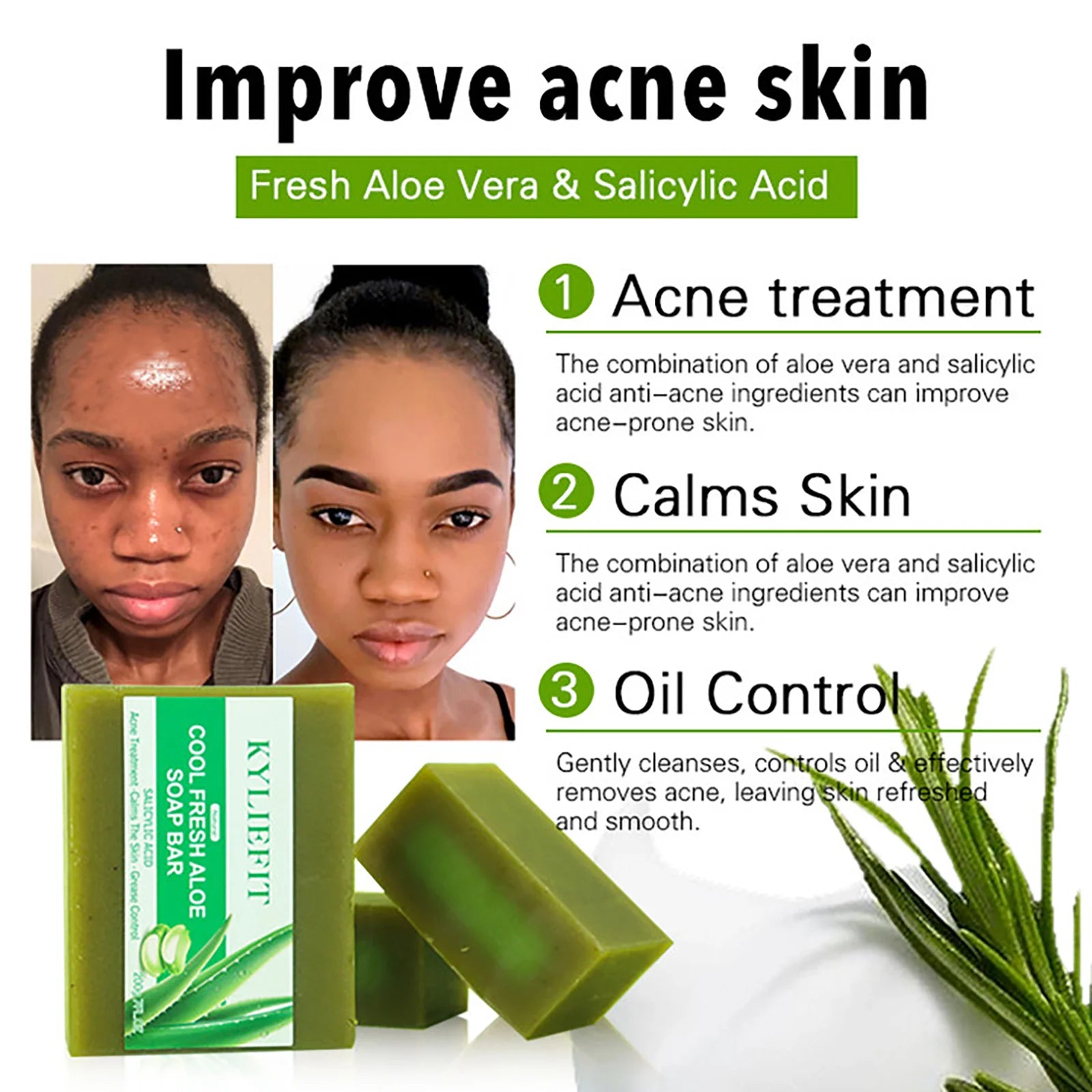 KYLIEFIT Cool Fresh Aloe Soap Bar, Reduce Acne and Black Spots, Clean Skin, Oil Control, Exfoliation, for Face and Body Use